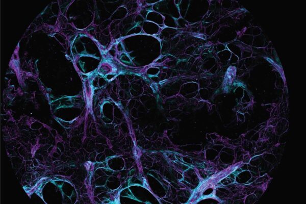 Matrix network of human lung parenchyma