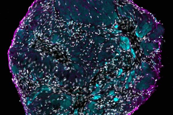 Mechanical force-induced fibrosis in animal-free synovial organoid, Alexandra Damerau