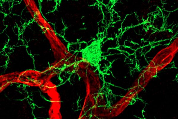 Microglial Exploration of the Extracellular Matrix - Navigating the Vascular Basement Membrane, Kishan Kapupara