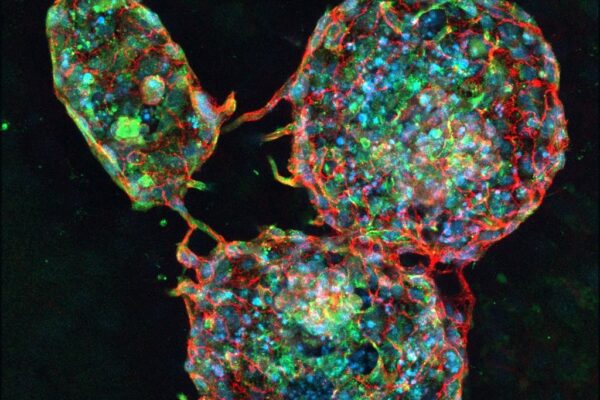 Laminin-Secreting Brain Endothelial Cell Shperoids in Hydrogel, Yiling Tsang